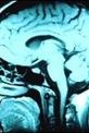 Обложка Фильм BBC: Тайны мозга (Brain stories)